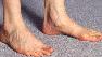 Feet