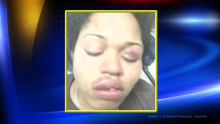 Stephanie Nickerson claimed police brutality during a scuffle in Durham, but police said the woman was resisting arrest.
