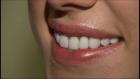 Cheap Teeth Whitening