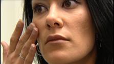 Skin Glossary Skin Glossary