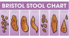 Poop 101