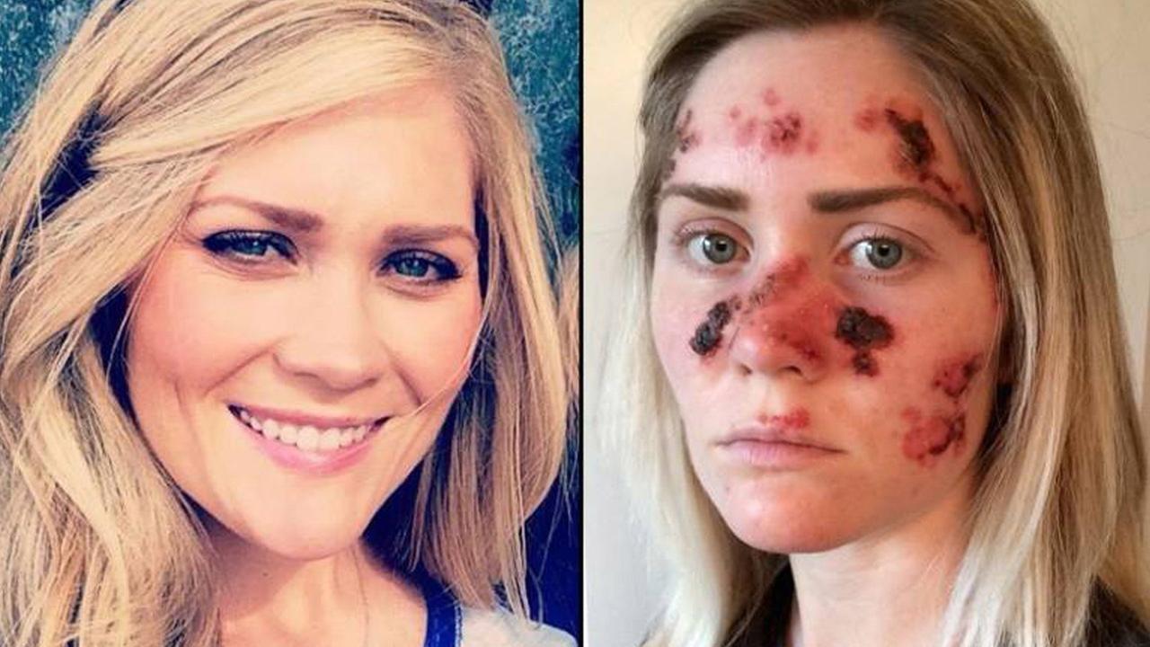 هذه الصور تحذركن جميعا.. خذوها على محمل الجد 1 هذه الصور تحذركن جميعا.. خذوها على محمل الجد